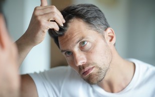 كابوس الصلع لدى الرجال.. هل ينتهي بعد زراعة الشعر؟