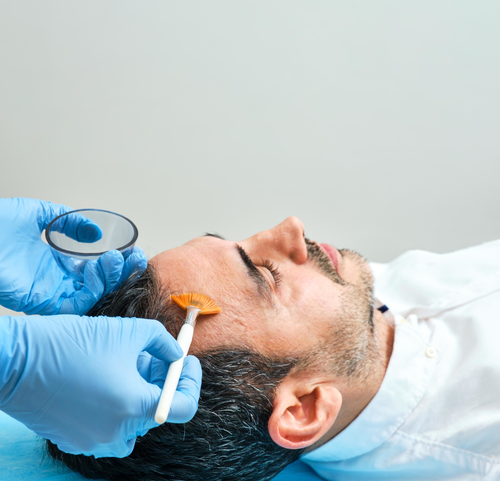 التقشير الكيميائي أحد العلاجات الموضعية للتخلص من تجاعيد الوجه